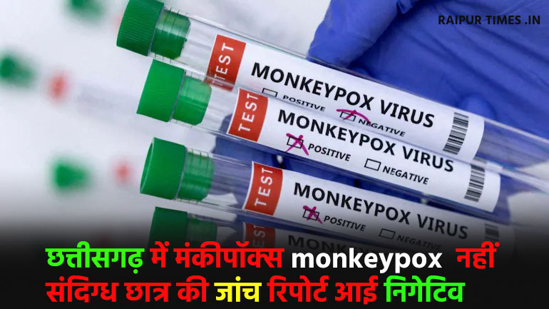 no monkeypox in chhattisgarh